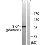 Western blot - MER/SKY (Phospho-Tyr749/681) Antibody from Signalway Antibody (11740) - Antibodies.com