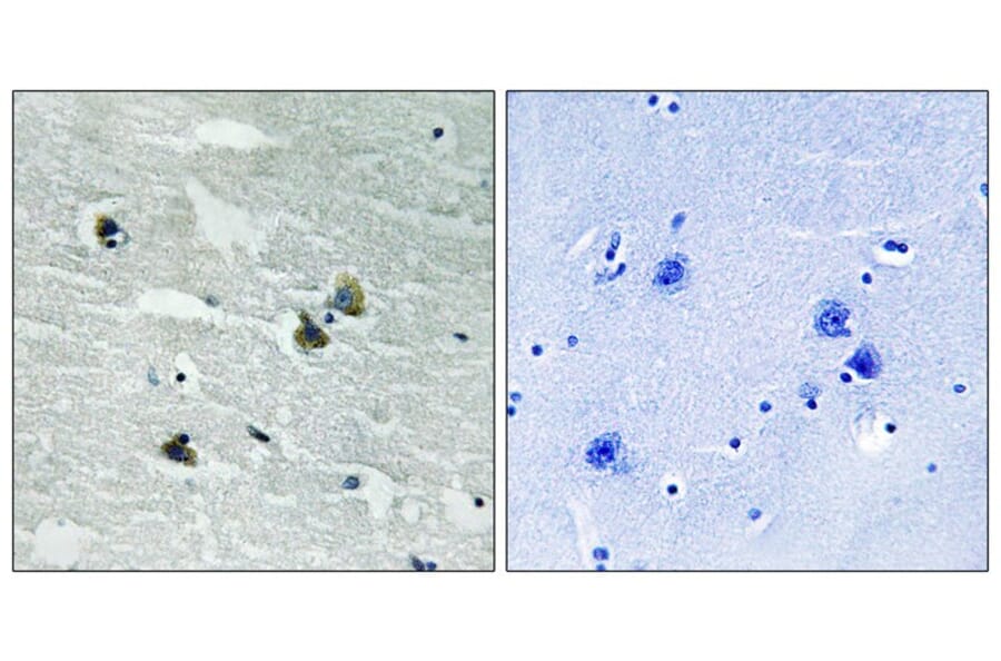 Immunohistochemistry - MER/SKY (Phospho-Tyr749/681) Antibody from Signalway Antibody (11740) - Antibodies.com