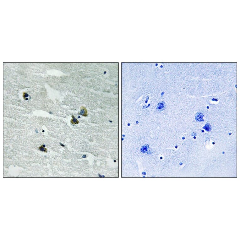 Immunohistochemistry - MER/SKY (Phospho-Tyr749/681) Antibody from Signalway Antibody (11740) - Antibodies.com