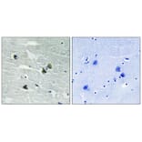 Immunohistochemistry - MER/SKY (Phospho-Tyr749/681) Antibody from Signalway Antibody (11740) - Antibodies.com