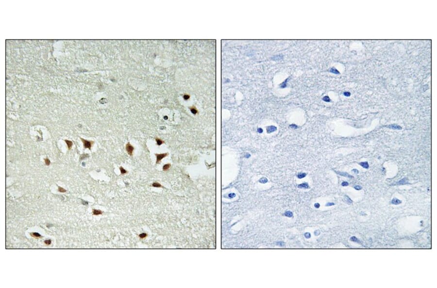 Immunohistochemistry - MAPKAPK2 (Phospho-Thr334) Antibody from Signalway Antibody (12103) - Antibodies.com