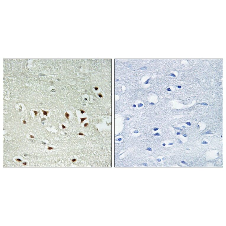 Immunohistochemistry - MAPKAPK2 (Phospho-Thr334) Antibody from Signalway Antibody (12103) - Antibodies.com
