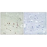 Immunohistochemistry - MAPKAPK2 (Phospho-Thr334) Antibody from Signalway Antibody (12103) - Antibodies.com