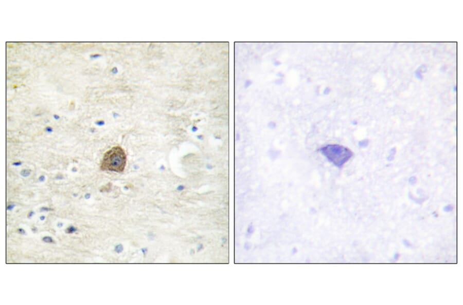 Immunohistochemistry - CaMK2α/β/δ (Phospho-Thr305) Antibody from Signalway Antibody (11644)