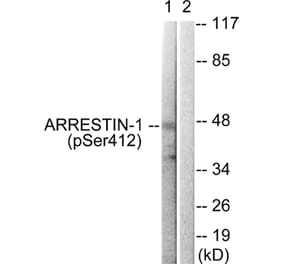Western blot - Arrestin 1 (Phospho-Ser412) Antibody from Signalway Antibody (11654) - Antibodies.com