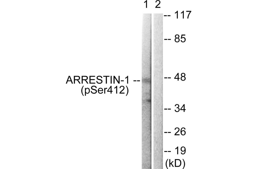 Western blot - Arrestin 1 (Phospho-Ser412) Antibody from Signalway Antibody (11654) - Antibodies.com