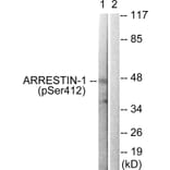 Western blot - Arrestin 1 (Phospho-Ser412) Antibody from Signalway Antibody (11654) - Antibodies.com