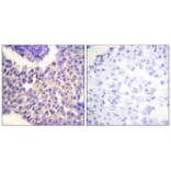 Immunohistochemistry - Arrestin 1 (Phospho-Ser412) Antibody from Signalway Antibody (11654) - Antibodies.com