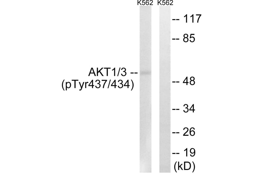 Western blot - AKT1/3 (Phospho-Tyr437/434) Antibody from Signalway Antibody (12116) - Antibodies.com