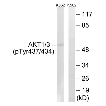 Western blot - AKT1/3 (Phospho-Tyr437/434) Antibody from Signalway Antibody (12116) - Antibodies.com