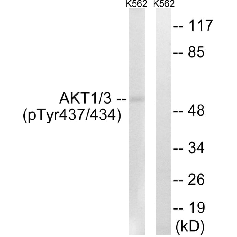 Western blot - AKT1/3 (Phospho-Tyr437/434) Antibody from Signalway Antibody (12116) - Antibodies.com