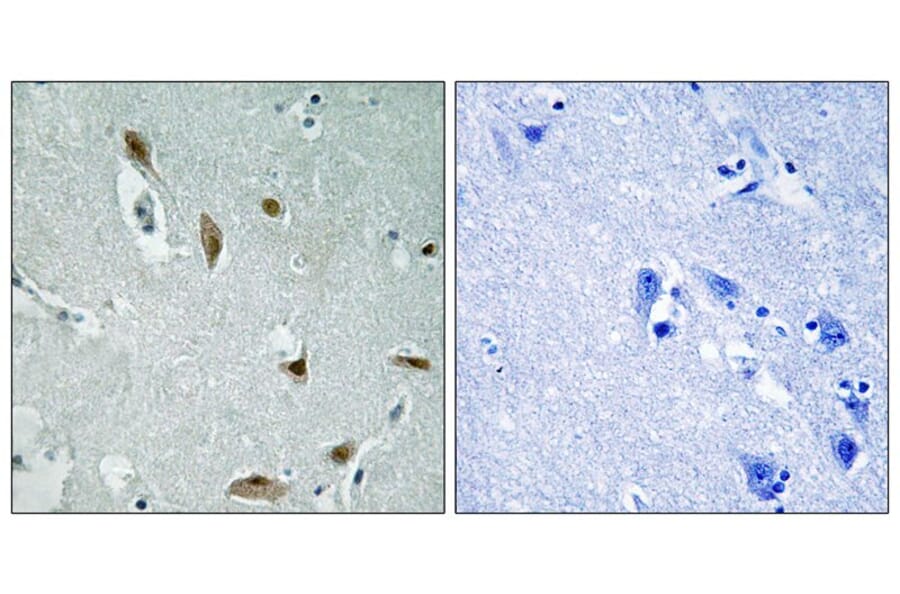 Immunohistochemistry - AKT1/3 (Phospho-Tyr437/434) Antibody from Signalway Antibody (12116) - Antibodies.com