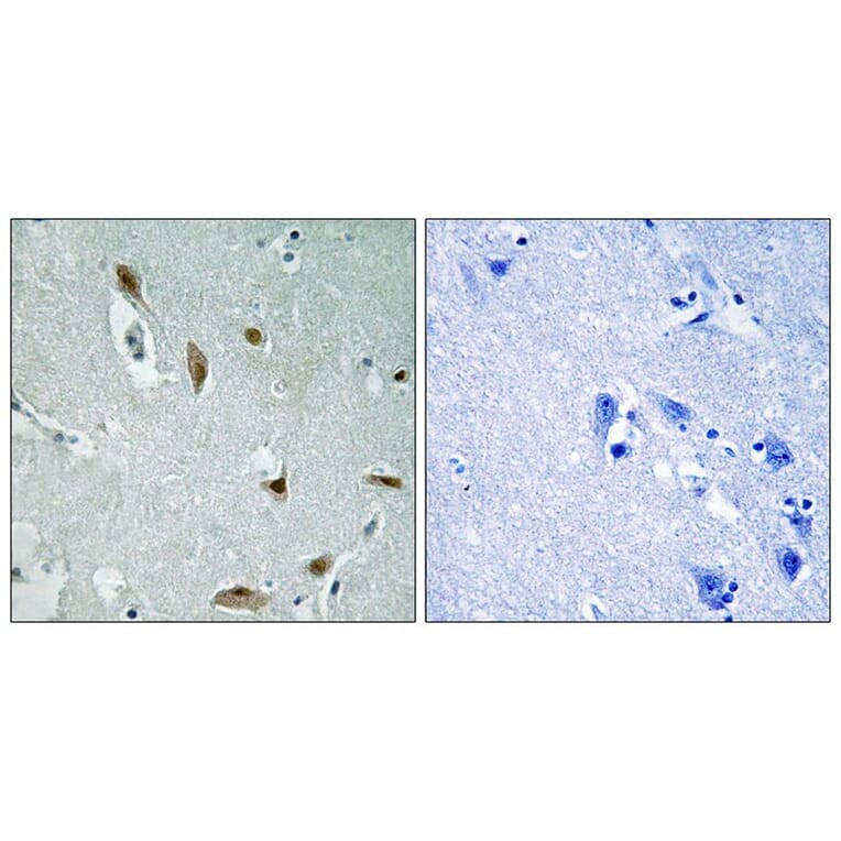 Immunohistochemistry - AKT1/3 (Phospho-Tyr437/434) Antibody from Signalway Antibody (12116) - Antibodies.com
