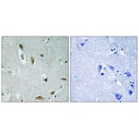 Immunohistochemistry - AKT1/3 (Phospho-Tyr437/434) Antibody from Signalway Antibody (12116) - Antibodies.com