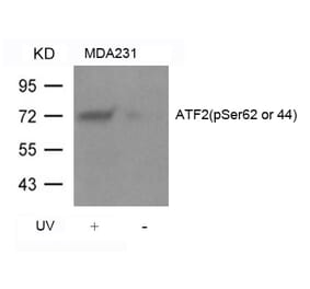 Western blot - ATF2 (Phospho-Ser62 or 44) Antibody from Signalway Antibody (11029) - Antibodies.com