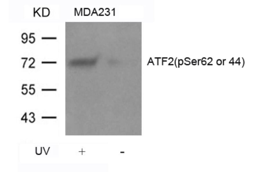 Western blot - ATF2 (Phospho-Ser62 or 44) Antibody from Signalway Antibody (11029) - Antibodies.com