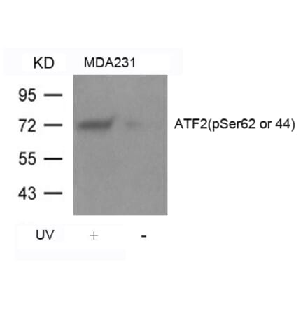 Western blot - ATF2 (Phospho-Ser62 or 44) Antibody from Signalway Antibody (11029) - Antibodies.com