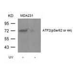 Western blot - ATF2 (Phospho-Ser62 or 44) Antibody from Signalway Antibody (11029) - Antibodies.com