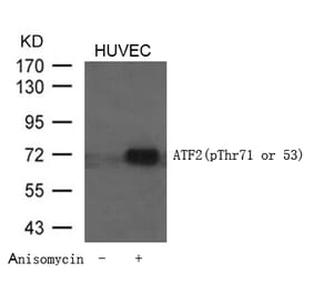 Western blot - ATF2 (Phospho-Thr71 or 53) Antibody from Signalway Antibody (11031) - Antibodies.com