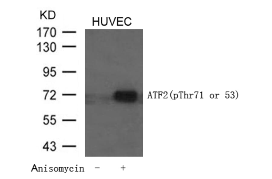 Western blot - ATF2 (Phospho-Thr71 or 53) Antibody from Signalway Antibody (11031) - Antibodies.com
