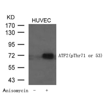 Western blot - ATF2 (Phospho-Thr71 or 53) Antibody from Signalway Antibody (11031) - Antibodies.com