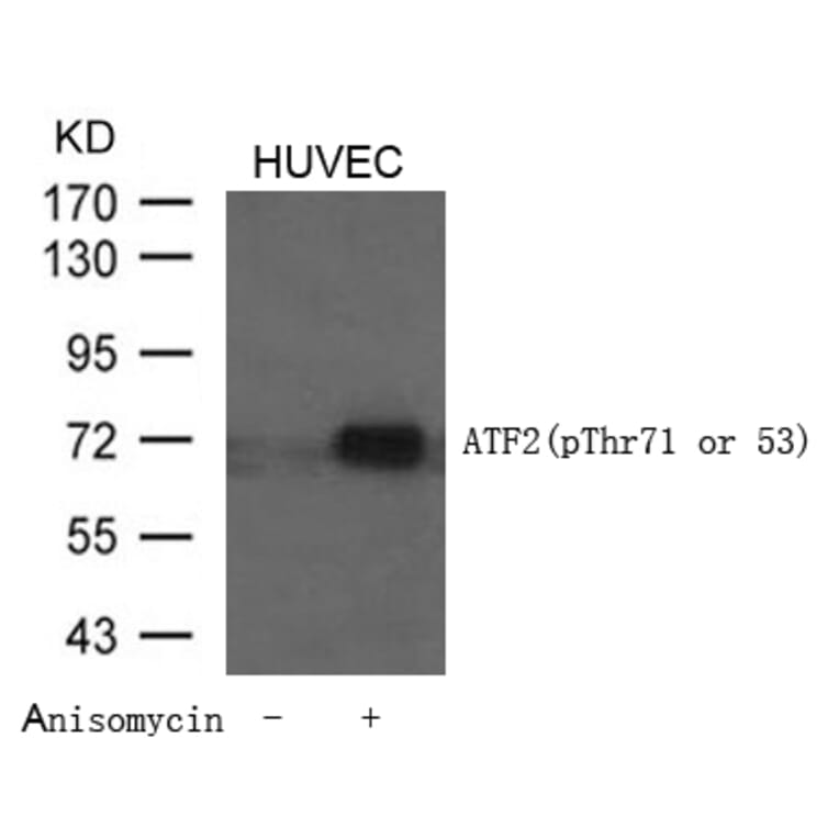 Western blot - ATF2 (Phospho-Thr71 or 53) Antibody from Signalway Antibody (11031) - Antibodies.com