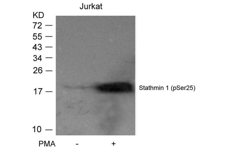Western blot - Stathmin1 (Phospho-Ser25) Antibody from Signalway Antibody (11224) - Antibodies.com