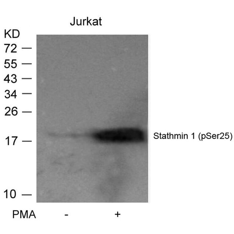 Western blot - Stathmin1 (Phospho-Ser25) Antibody from Signalway Antibody (11224) - Antibodies.com