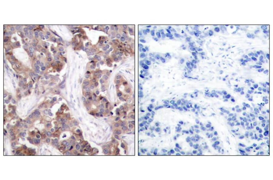 Immunohistochemistry - Stathmin1 (Phospho-Ser25) Antibody from Signalway Antibody (11224) - Antibodies.com