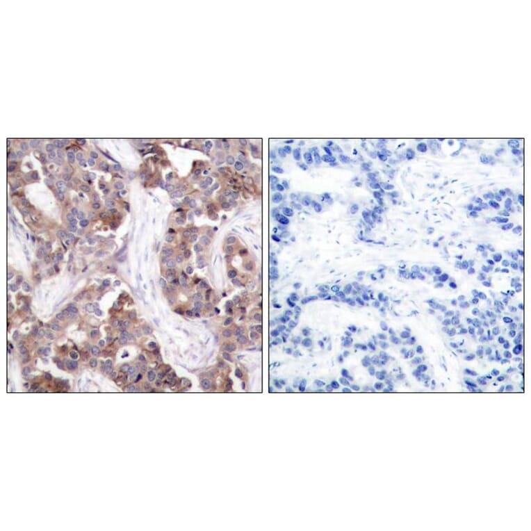 Immunohistochemistry - Stathmin1 (Phospho-Ser25) Antibody from Signalway Antibody (11224) - Antibodies.com