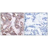 Immunohistochemistry - Stathmin1 (Phospho-Ser25) Antibody from Signalway Antibody (11224) - Antibodies.com