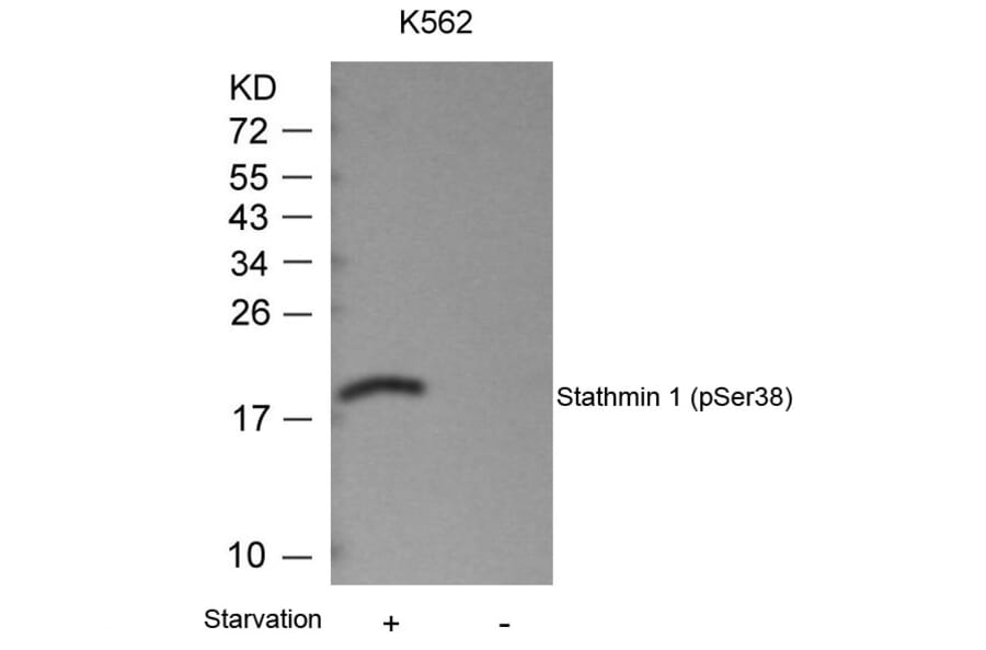 Western blot - Stathmin1 (Phospho-Ser38) Antibody from Signalway Antibody (11225) - Antibodies.com