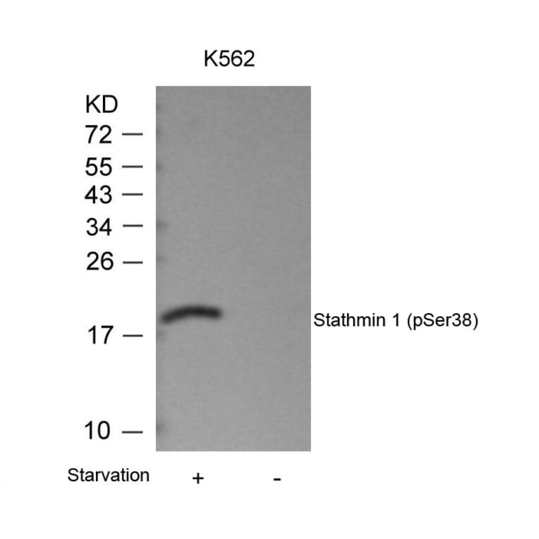 Western blot - Stathmin1 (Phospho-Ser38) Antibody from Signalway Antibody (11225) - Antibodies.com