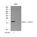 Western blot - Stathmin1 (Phospho-Ser38) Antibody from Signalway Antibody (11225) - Antibodies.com