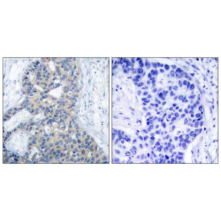 Immunohistochemistry - Stathmin1 (Phospho-Ser38) Antibody from Signalway Antibody (11225) - Antibodies.com