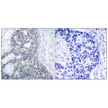 Immunohistochemistry - Stathmin1 (Phospho-Ser38) Antibody from Signalway Antibody (11225) - Antibodies.com