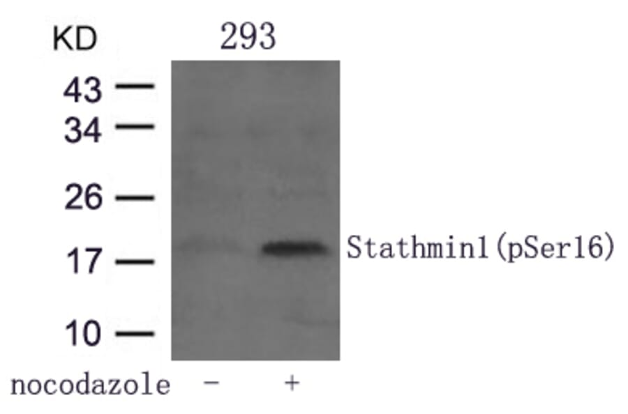Western blot - Stathmin1 (Phospho-Ser16) Antibody from Signalway Antibody (11234) - Antibodies.com
