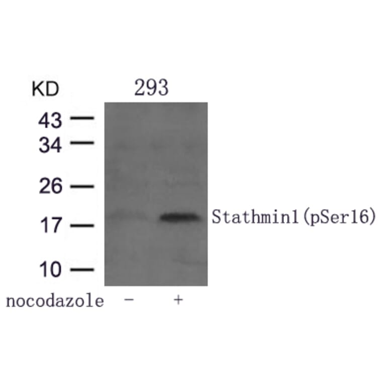 Western blot - Stathmin1 (Phospho-Ser16) Antibody from Signalway Antibody (11234) - Antibodies.com