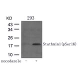 Western blot - Stathmin1 (Phospho-Ser16) Antibody from Signalway Antibody (11234) - Antibodies.com