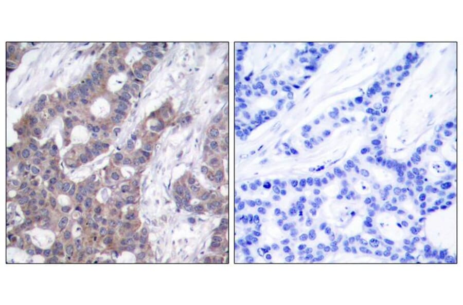 Immunohistochemistry - Stathmin1 (Phospho-Ser16) Antibody from Signalway Antibody (11234) - Antibodies.com