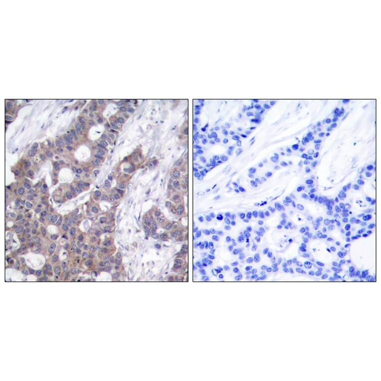 Immunohistochemistry - Stathmin1 (Phospho-Ser16) Antibody from Signalway Antibody (11234) - Antibodies.com