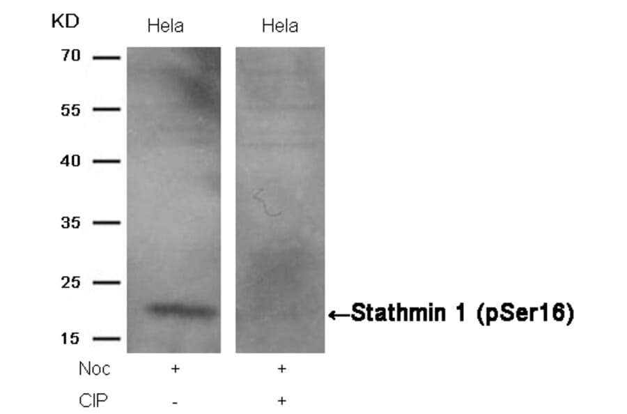 Western blot - Stathmin1 (Phospho-Ser16) Antibody from Signalway Antibody (11234) - Antibodies.com