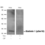 Western blot - Stathmin1 (Phospho-Ser16) Antibody from Signalway Antibody (11234) - Antibodies.com