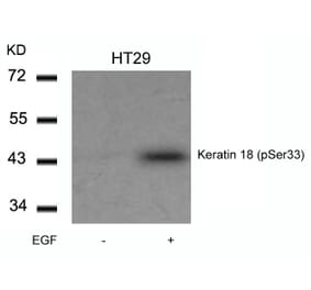 Western blot - Keratin 18 (Phospho-Ser33) Antibody from Signalway Antibody (11306) - Antibodies.com