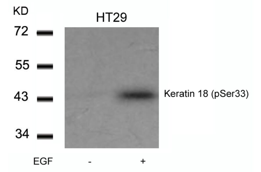 Western blot - Keratin 18 (Phospho-Ser33) Antibody from Signalway Antibody (11306) - Antibodies.com