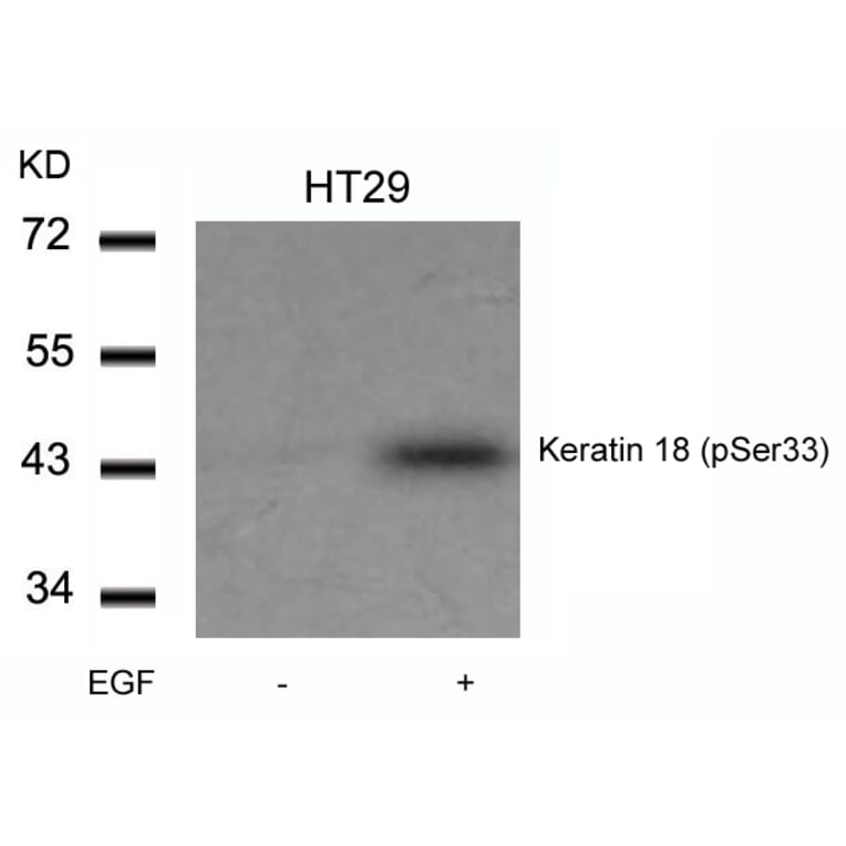 Western blot - Keratin 18 (Phospho-Ser33) Antibody from Signalway Antibody (11306) - Antibodies.com