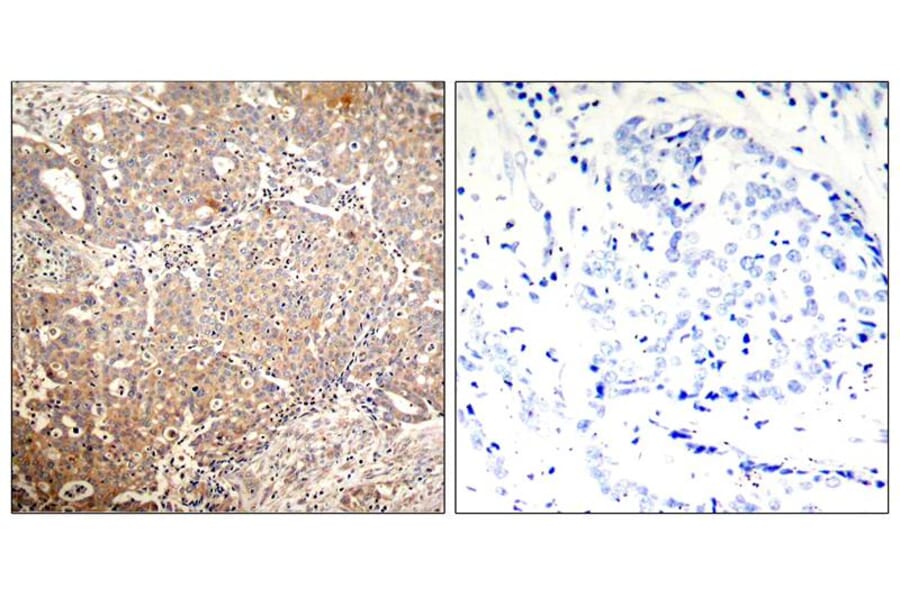 Immunohistochemistry - Keratin 18 (Phospho-Ser33) Antibody from Signalway Antibody (11306) - Antibodies.com