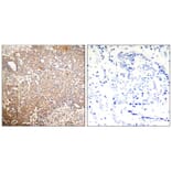 Immunohistochemistry - Keratin 18 (Phospho-Ser33) Antibody from Signalway Antibody (11306) - Antibodies.com