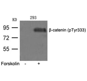 Western blot - β-catenin (phospho-Tyr333) Antibody from Signalway Antibody (11574) - Antibodies.com