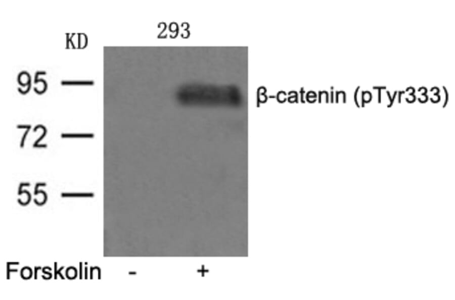 Western blot - β-catenin (phospho-Tyr333) Antibody from Signalway Antibody (11574) - Antibodies.com